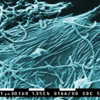 ebola