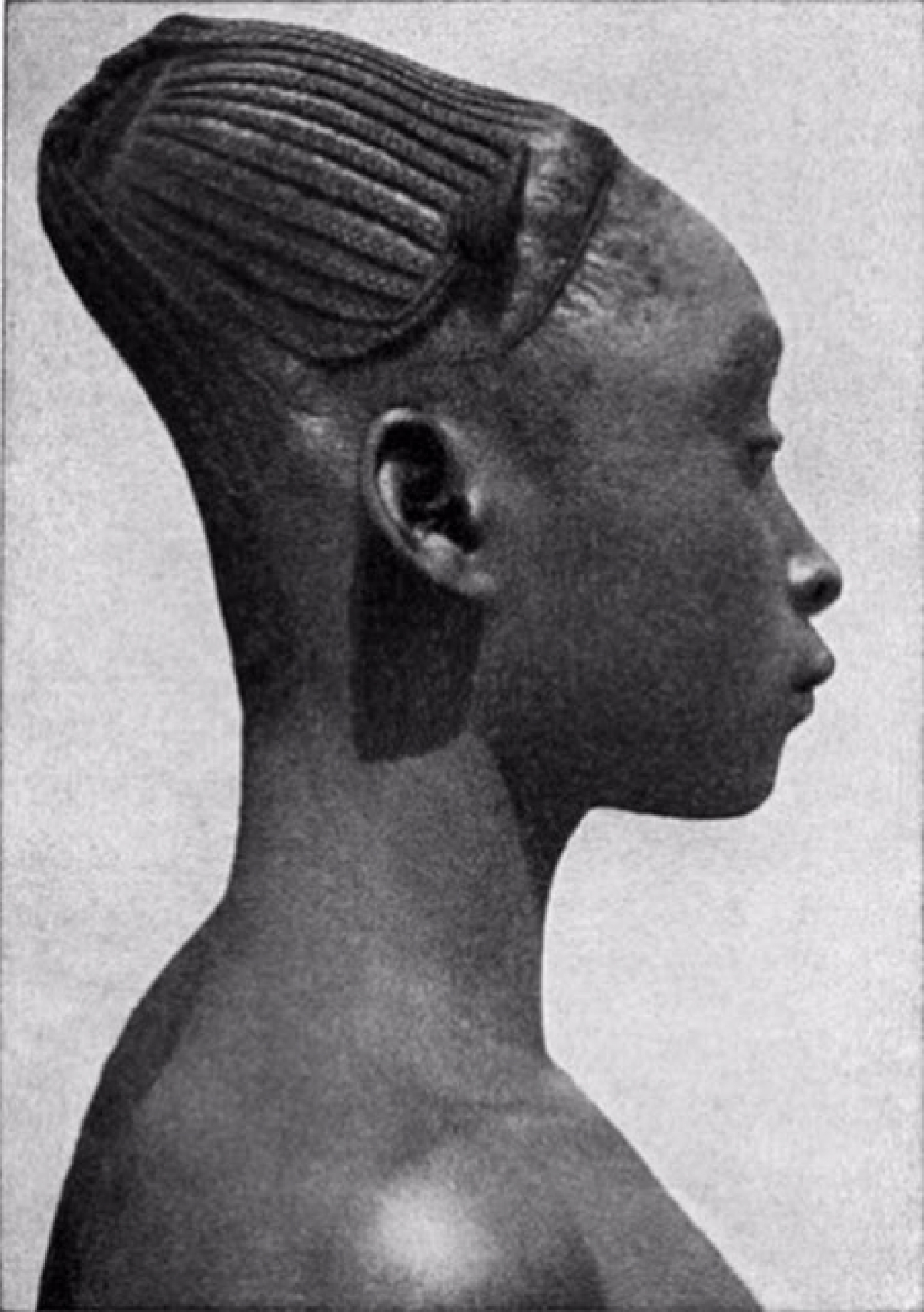 Большой затылок. Мангбету деформация черепа. Тулузская деформация черепа. Африканское племя мангбету.