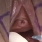 LumpyOne